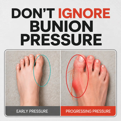 Adjustable Bunion Corrector